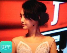 哪个明星做了假体下巴,美丽背后的秘密