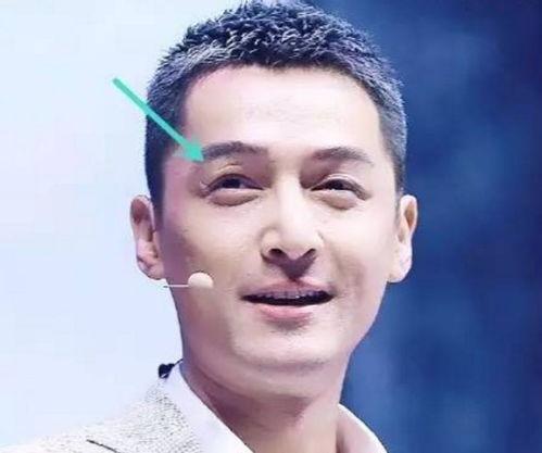 哪个男明星脸上有疤,逆境中的魅力与坚韧