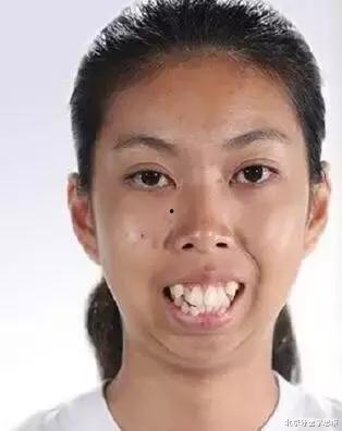 快手龅牙丑女网红照片