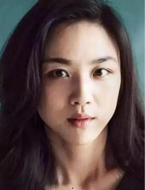 国外斜视明星,揭秘国外斜视明星的独特风采