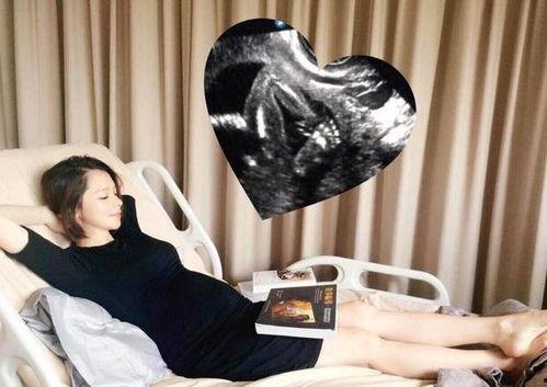 明星怎么保胎,科学育儿与明星妈妈们的孕期守护之道
